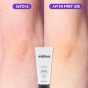 The Solution Retinol Smoothing Body Lotion before and after first use results