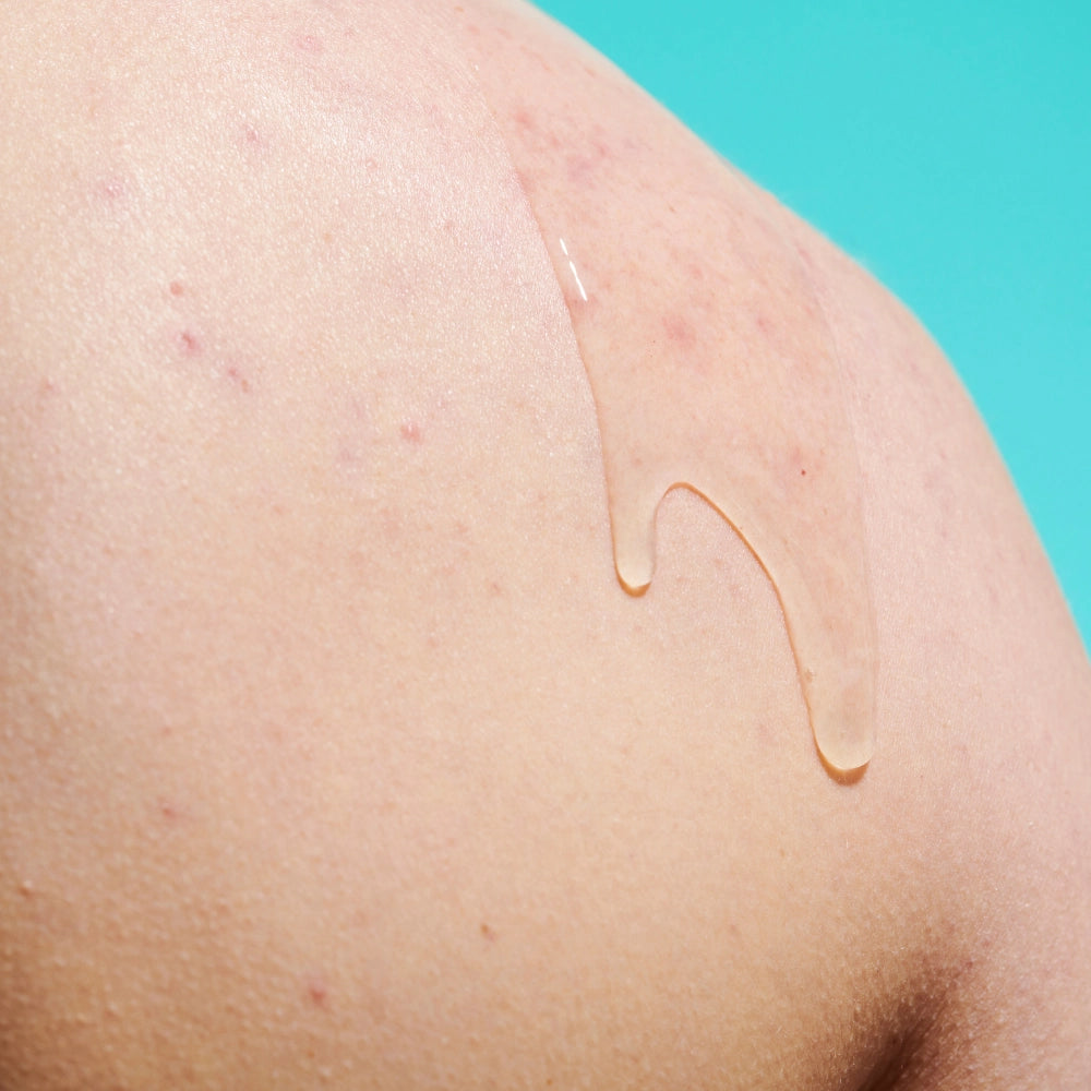 The Solution Salicylic Acid Clear Skin Body Gel formula on model's back