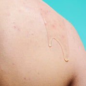 The Solution Salicylic Acid Clear Skin Body Gel formula on model's back