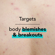 Targets body blemishes and breakouts