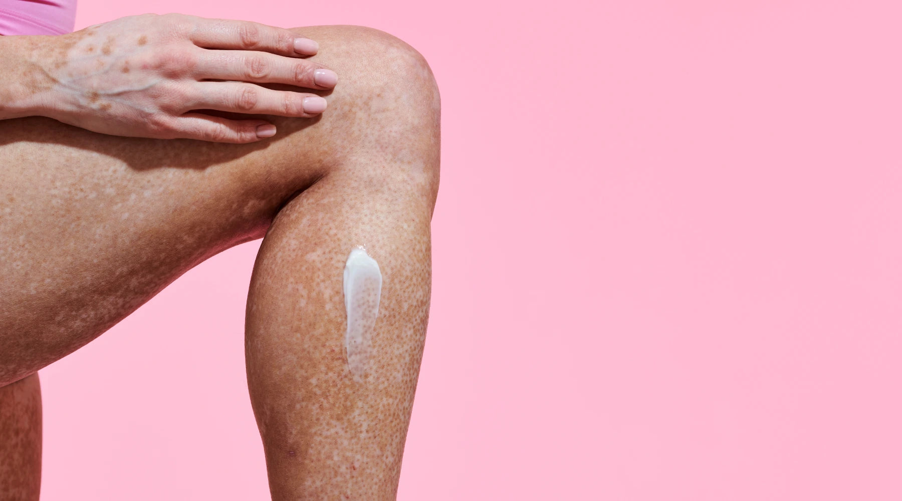 Woman applying body cream to dry skin on leg